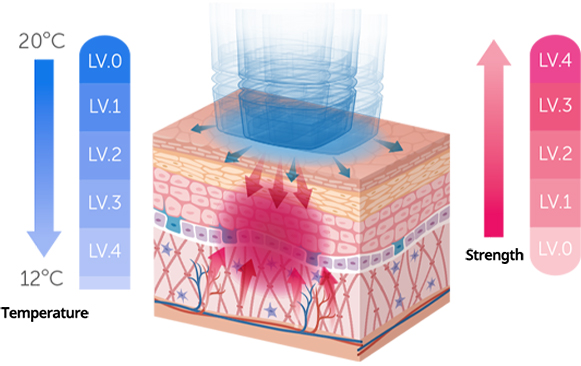 Lifting treatment with hydro-cooling and vibration levels to protect the skin surface and shorten recovery time