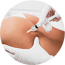 ID V邏輯身體PT注射個性化治療的圖片