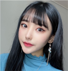 輪廓肉毒瘦臉讓下顎線清晰，臉部變小的明顯變化