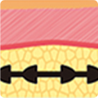 從第一代到第四代逐步升級的線雕結構