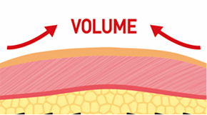 說明不同於普通線雕 可移動錐體避免神經刺激的原理
